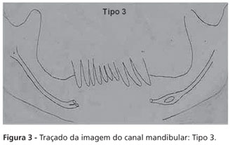 Mandíbula  Anatomia Odonto