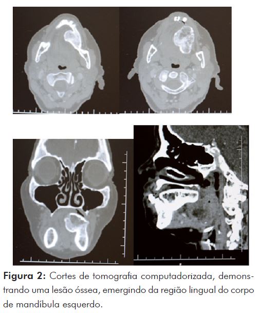 TC DE MANDIBULA • AMD Saúde