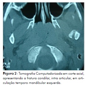 TC DE MANDIBULA • AMD Saúde