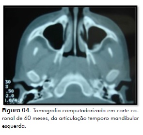 TC DE MANDIBULA • AMD Saúde