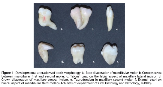 morphology deciduous anterior teeth