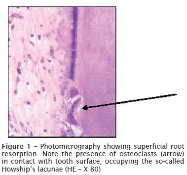 resorption definition teeth