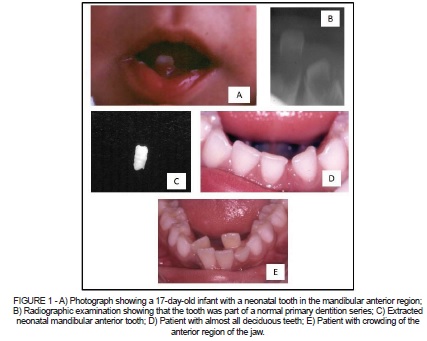 normal development of teeth